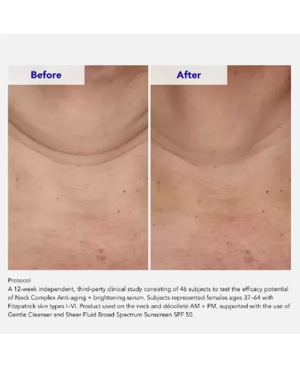 NECK COMPLEX ANTI-AGING + BRIGHTENING SERUM 50mL - Siero collo e décolleté ZO® Skin Health € 113,11 +VAT www.AntiAgeBoutique.com